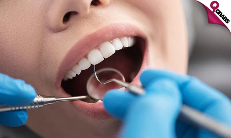 Teeth Whitening + Scaling + Polishing + Consultation!